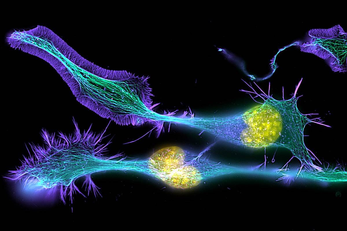 Nerve cells