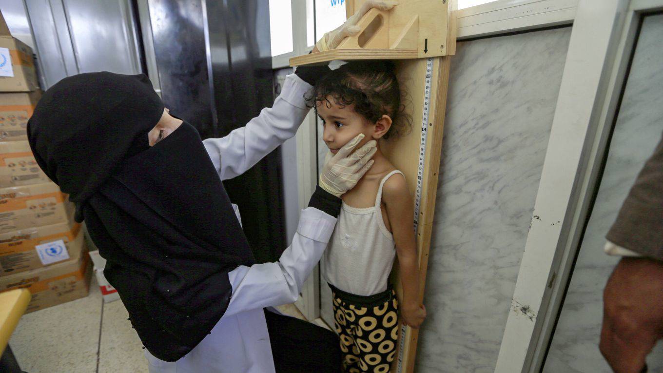 dousteblazy4_MOHAMMED HUWAISAFPGetty_child malnutrition