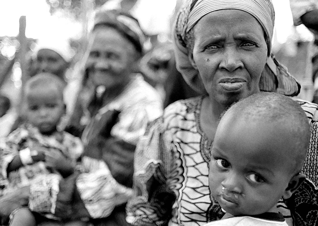 Child malnourished Kenya