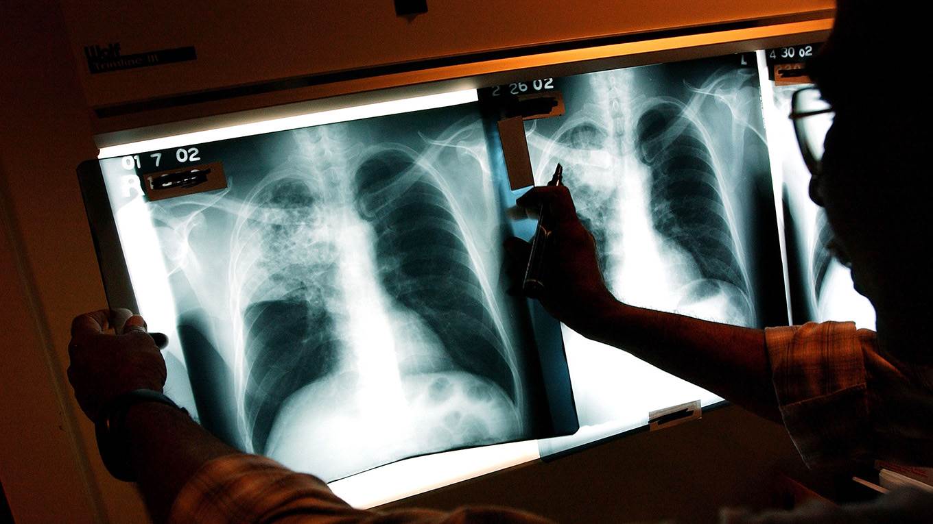 psmall1_ Spencer PlattGetty Images_tb diagnosis