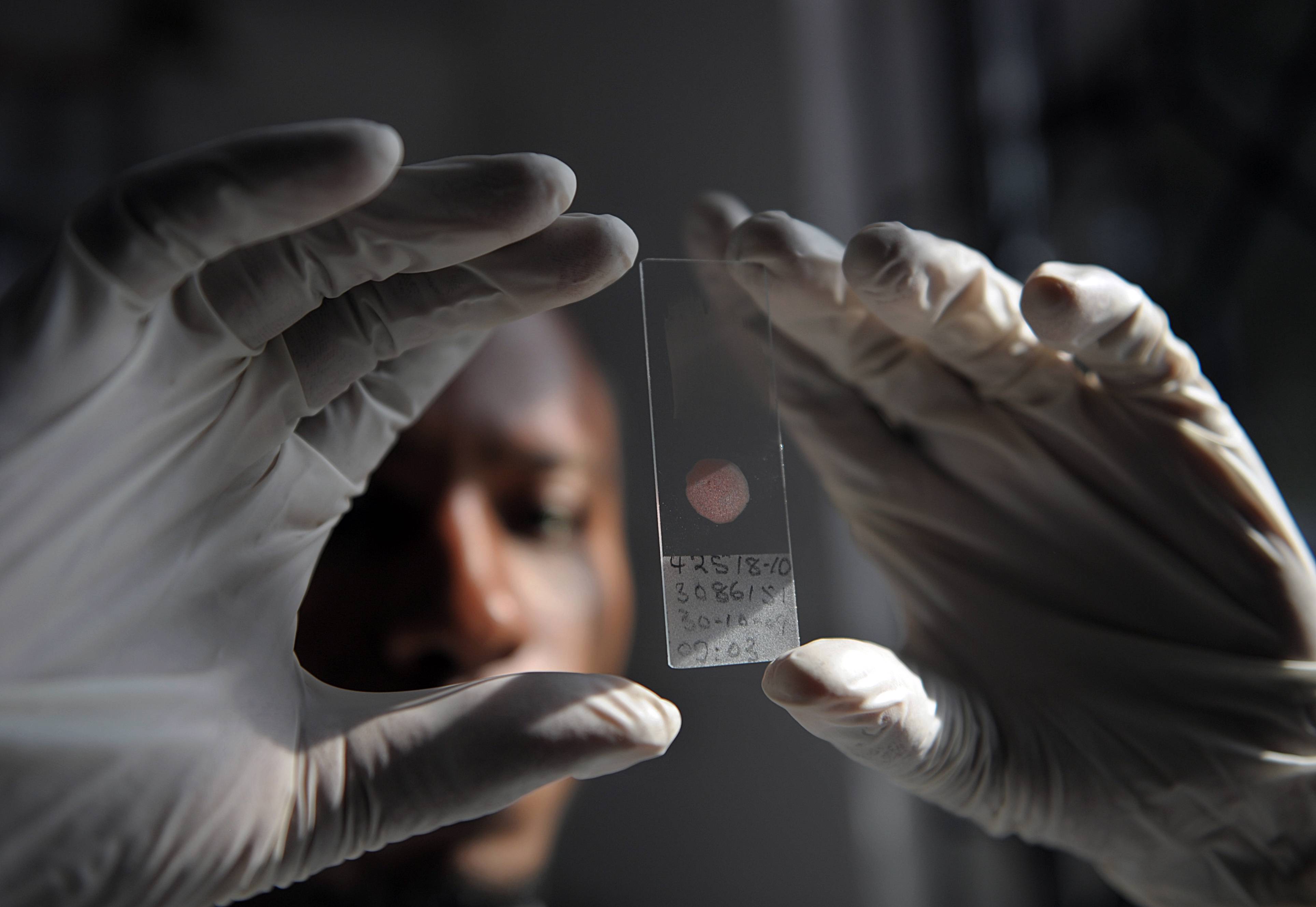 diallo2_TONY KARUMBAAFP via Getty Images_malaria test