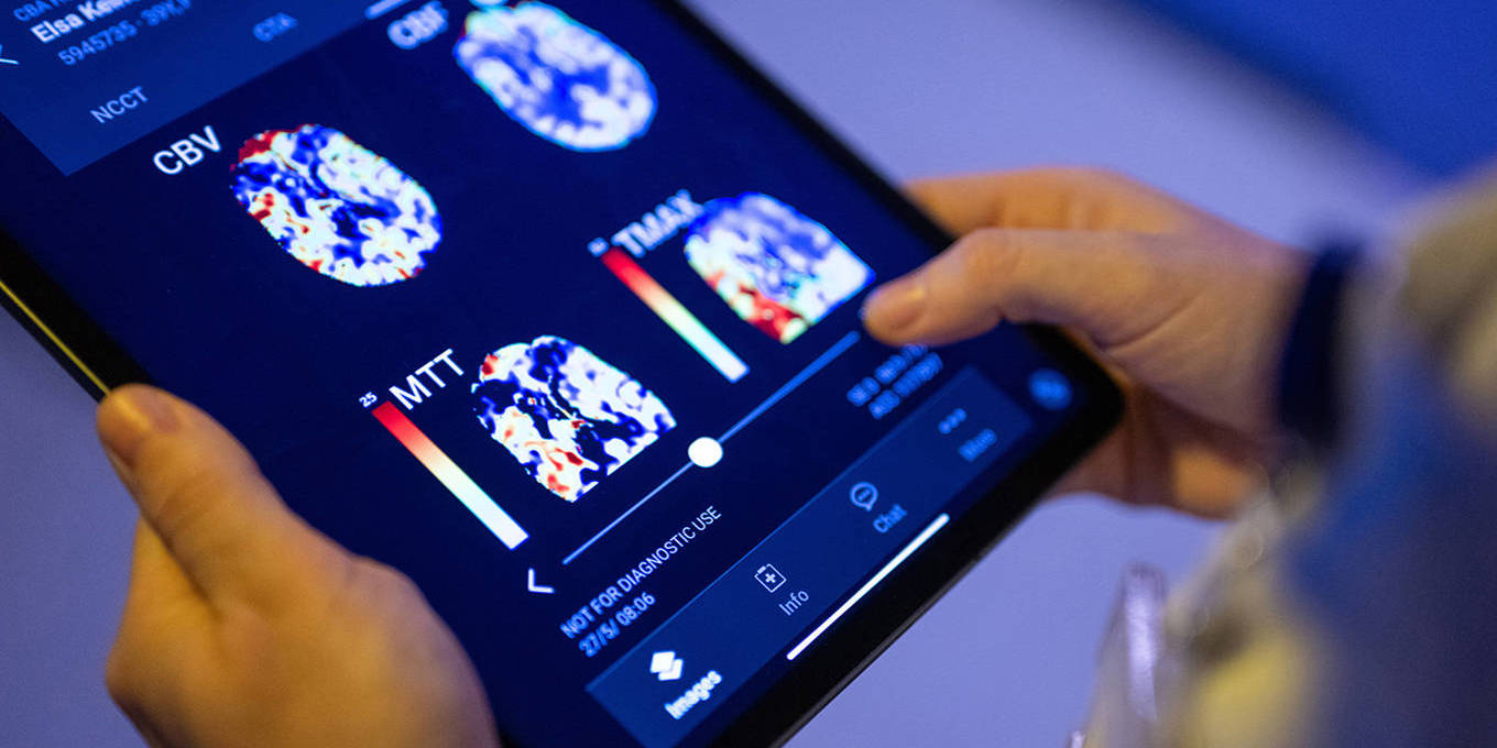 Investing in Brain Health