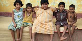Child obesity  in India