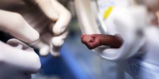 nsofor5_Conrad BornmanGallo ImagesGetty Images_premature baby