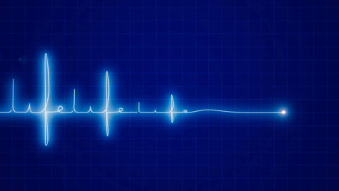 heart rate graph