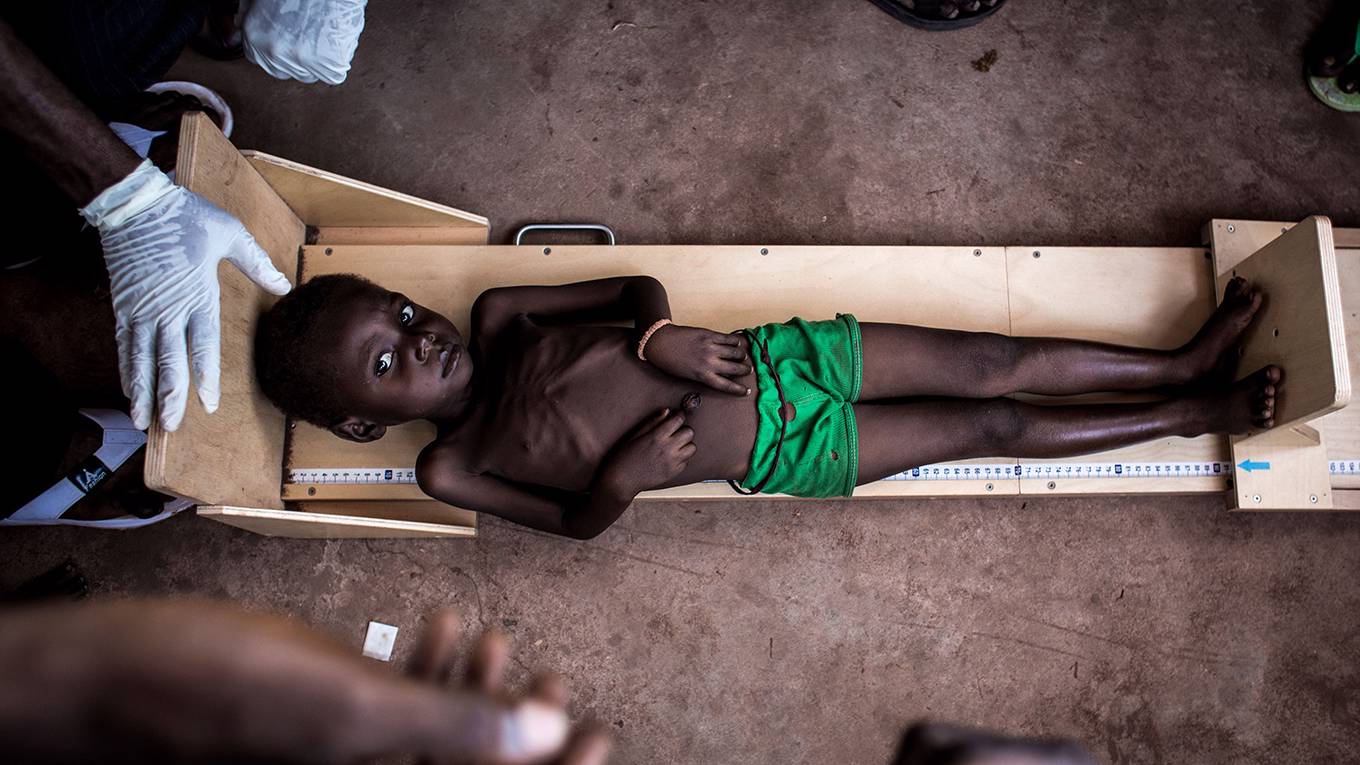 mannar1_JOHN WESSELSAFPGetty Images_childmeasuredmalnutrition