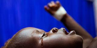 South Sudan malnutrition