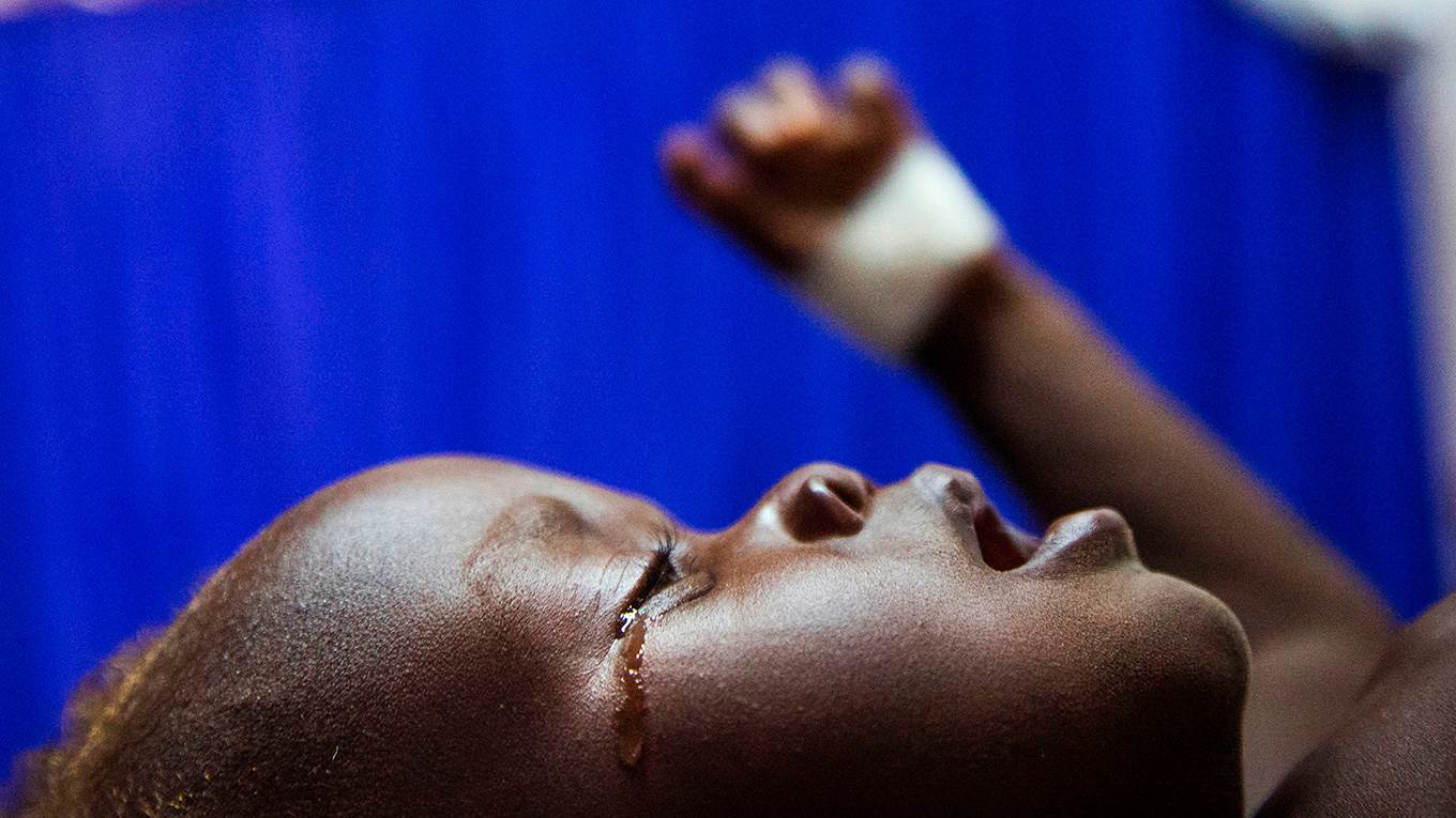 South Sudan malnutrition