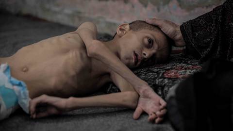 nowrojee4_Ahmed Jihad Ibrahim Al-ariniAnadoluGettyImages_children_gaza_starvation