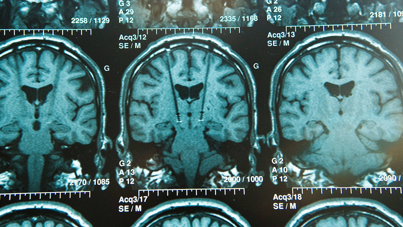 Brain scans