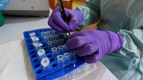 oyebanji2_ PIUS UTOMI EKPEIAFP via Getty Images_lassa fever
