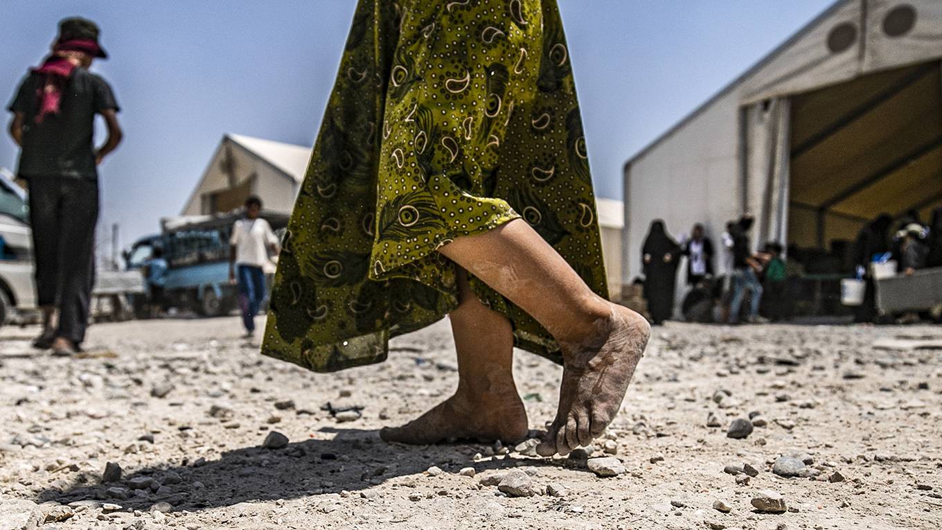 grandi6_DELIL SOULEIMANAFP via Getty Images_refugeechildbarefoot
