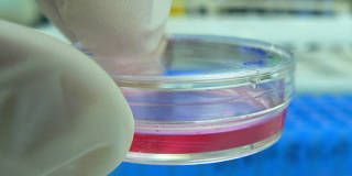 Petri dish cells