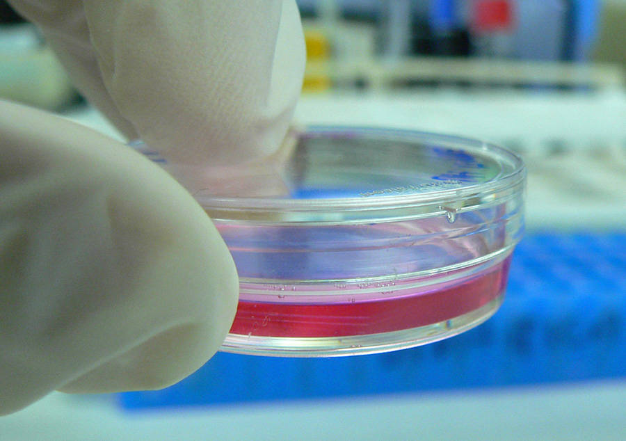 Petri dish cells