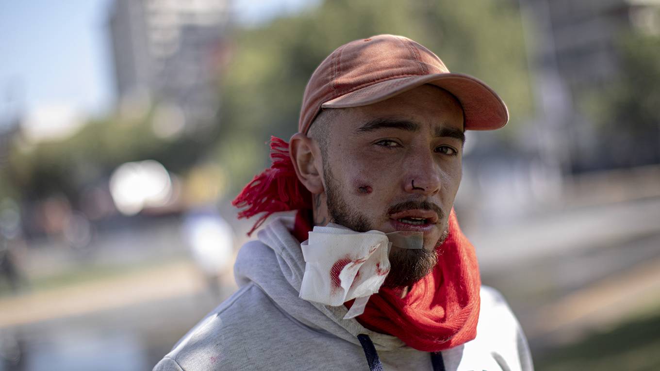 sachs315_Pablo Rojas MadariagaNurPhoto via Getty Images_chileprotestmanbulletface
