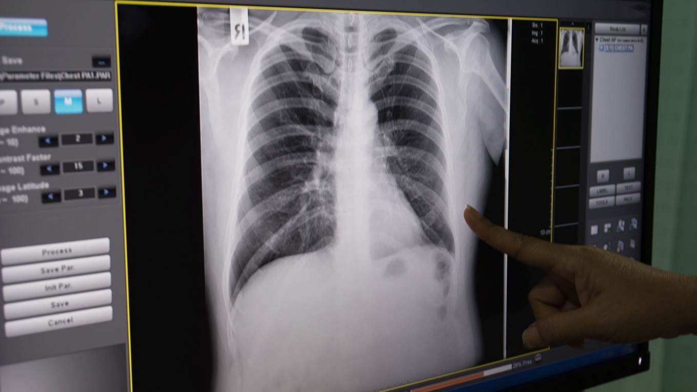 X-ray scan